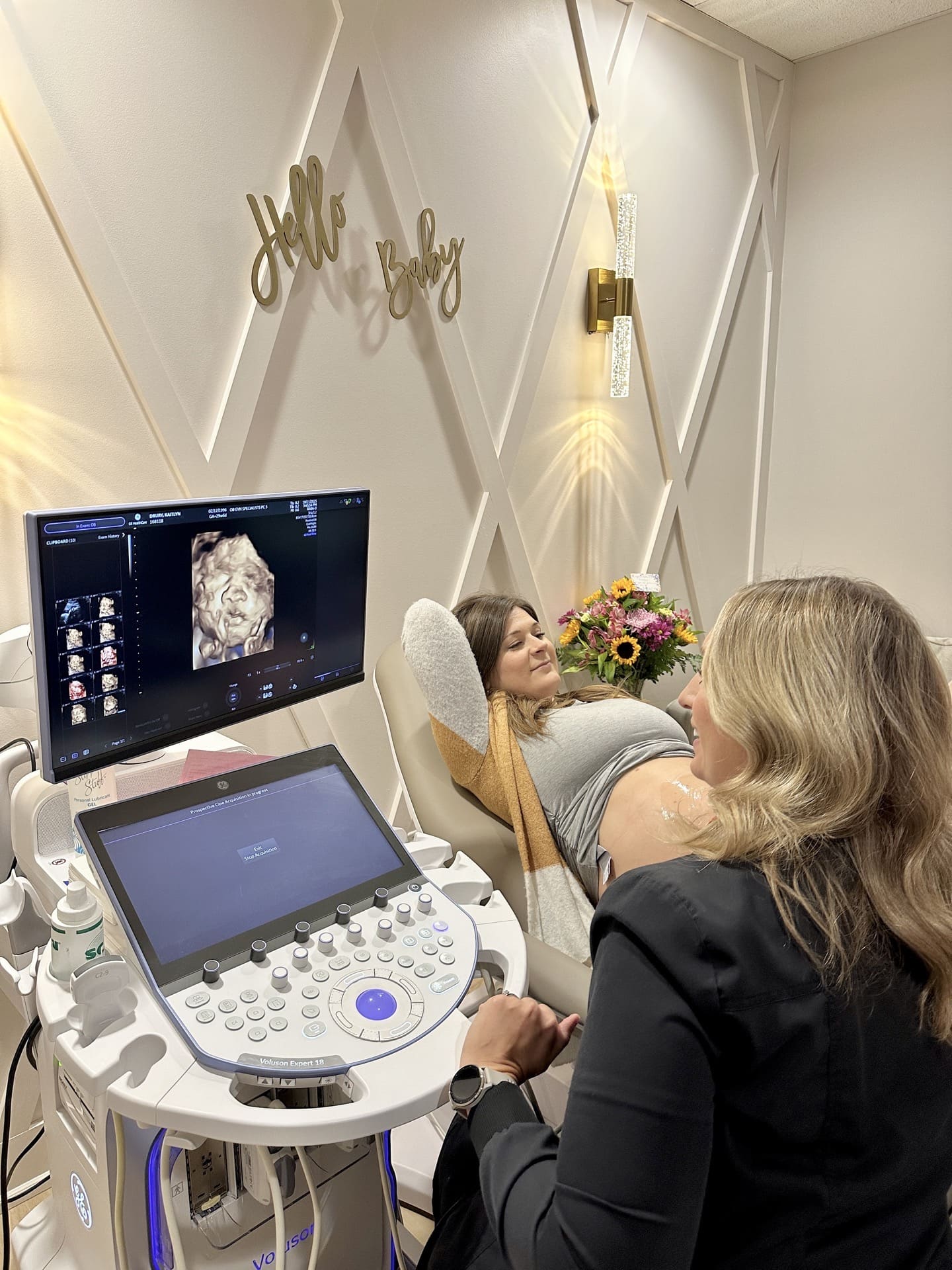 3D/4D ultrasound